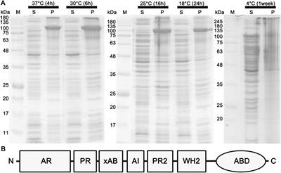 Studies of functional properties of espin 1: Its interaction to actin filaments